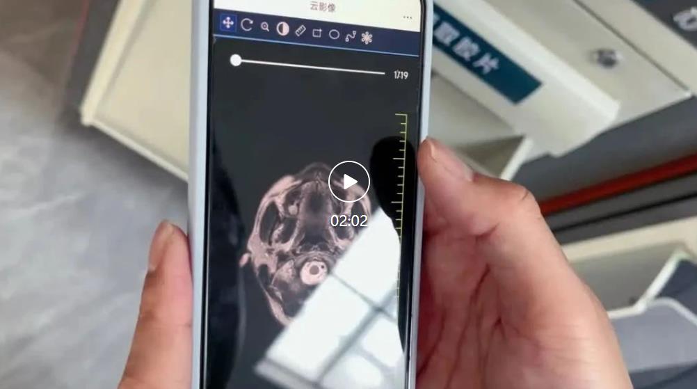 【临汾日报】市中心医院十大特色服务之九：手机一点 轻松“查片”